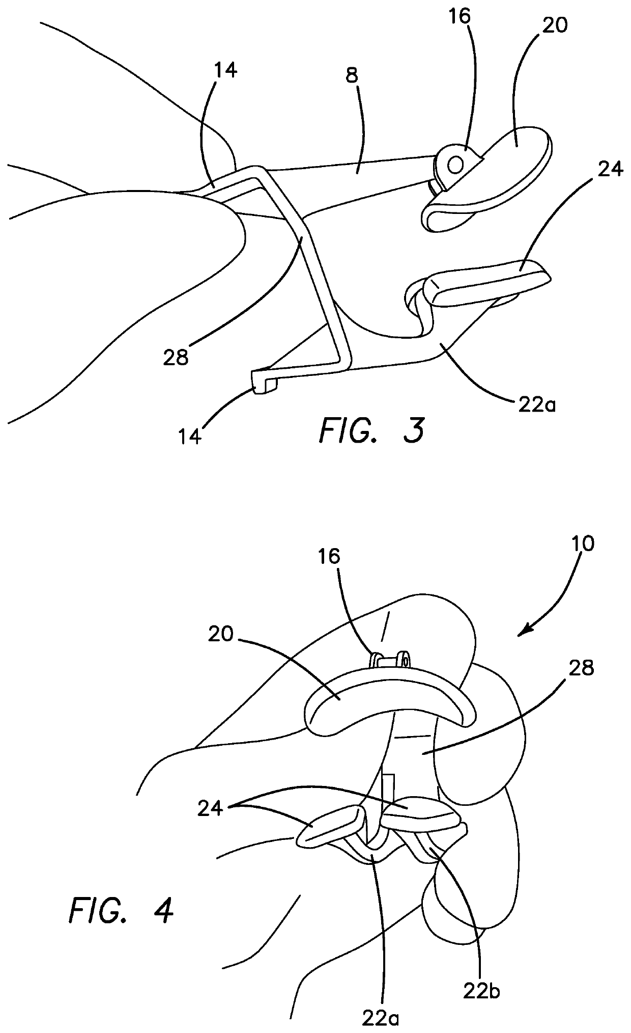 Compressive Nasal Device and Method for Using the Same