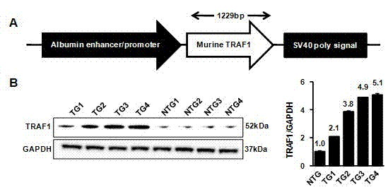 TNF (Tumor Necrosis Factor) receptor associated factor 1 (TARF1) and application of inhibitor thereof to liver ischemic disease