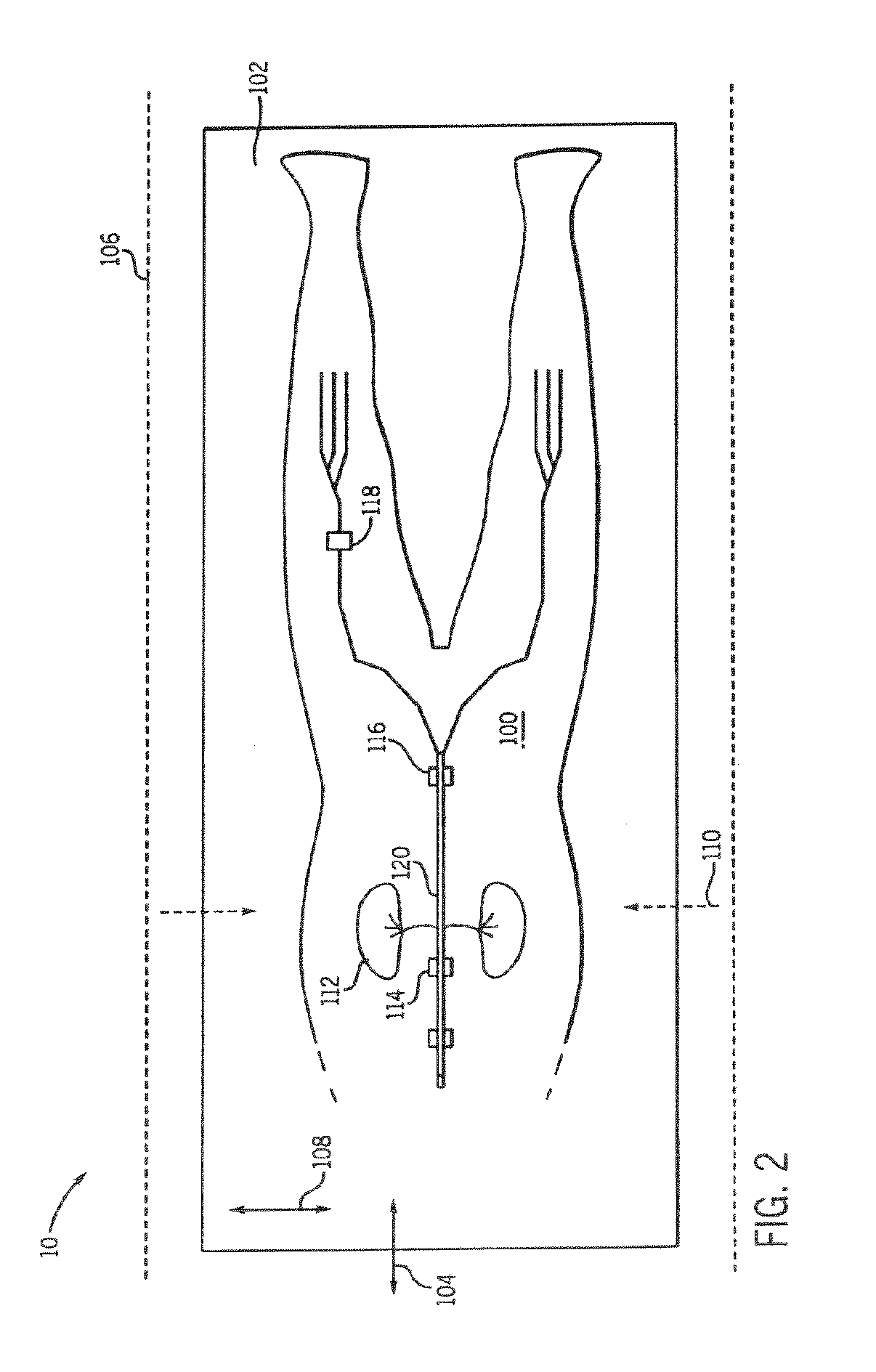 Whole body MRI scanning with moving table and interactive control