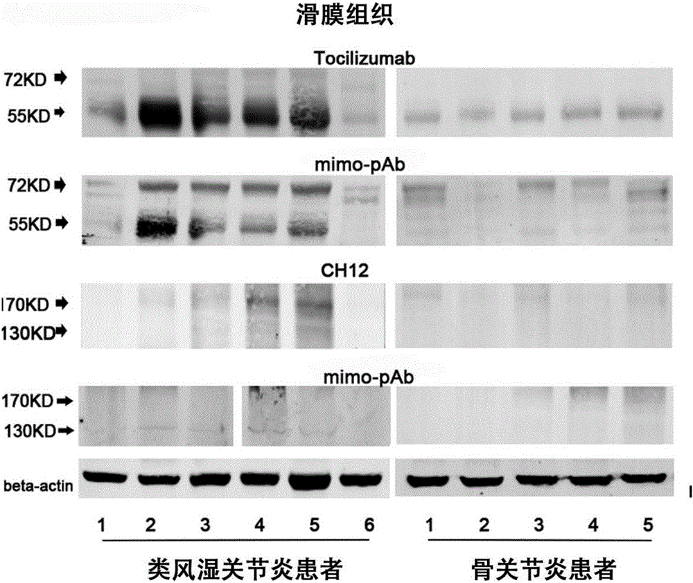 Tocilizumab/CH12 coupled simulated epitope