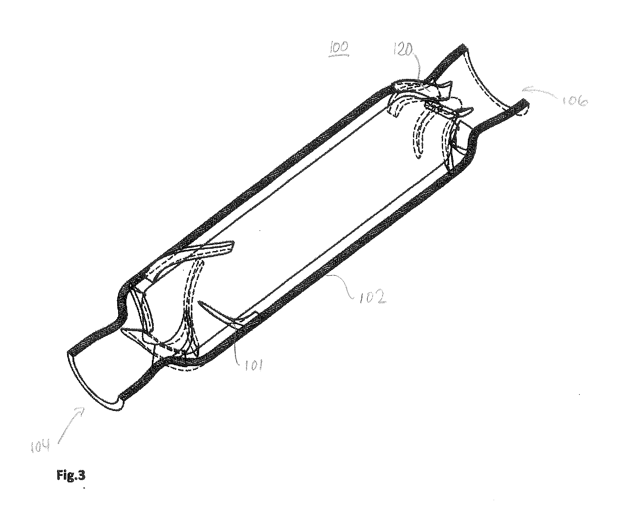 Blood pump with separate mixed-flow and axial-flow impeller stages and multi-stage stators