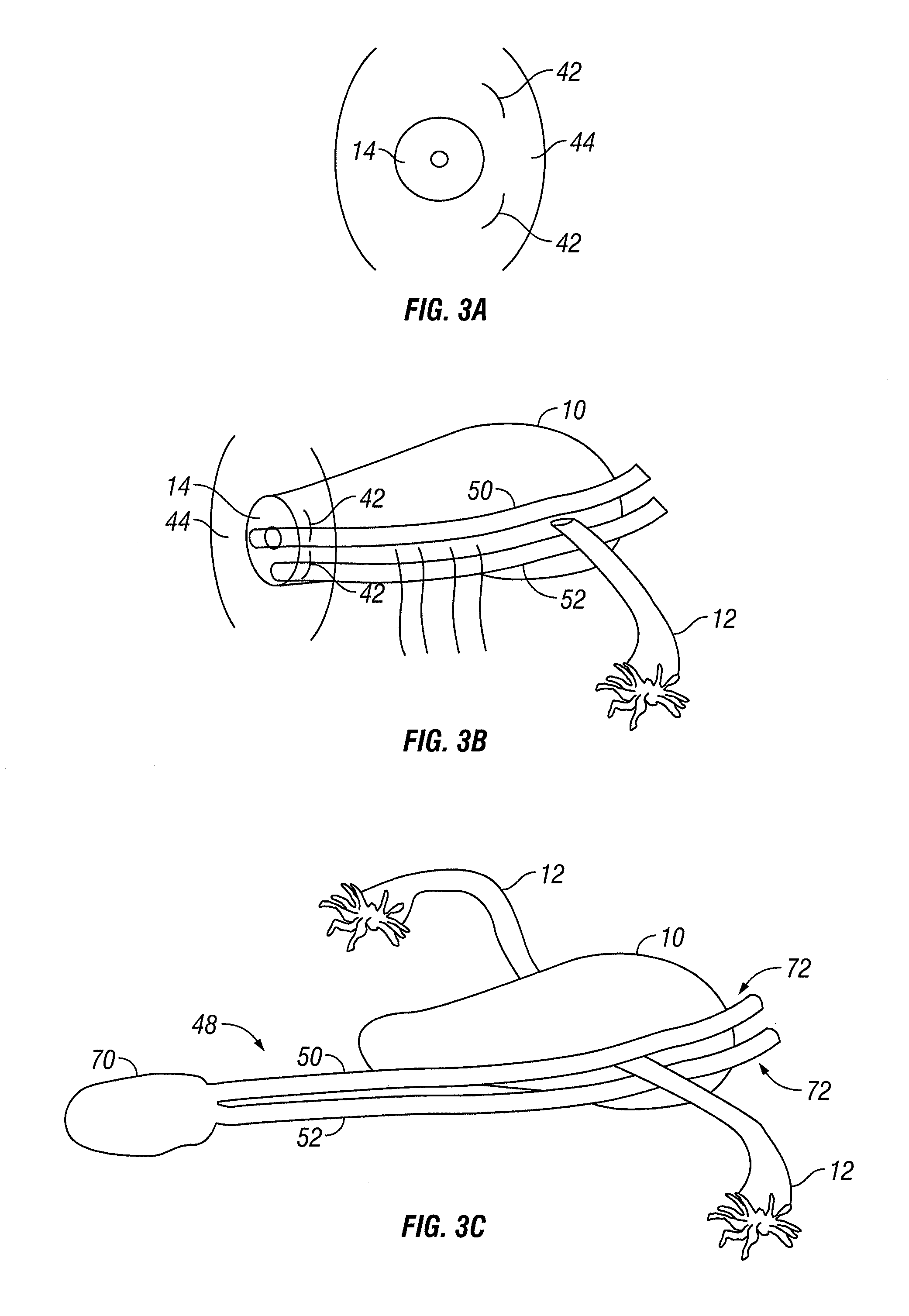 Method and apparatus for sealing tissue