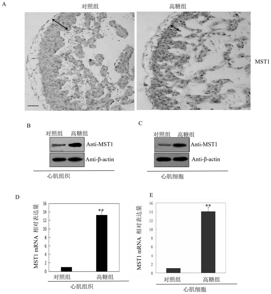 Application of MST1 gene in detecting and/or regulating excessive apoptosis of myocardial cells