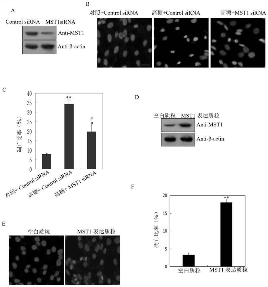 Application of MST1 gene in detecting and/or regulating excessive apoptosis of myocardial cells