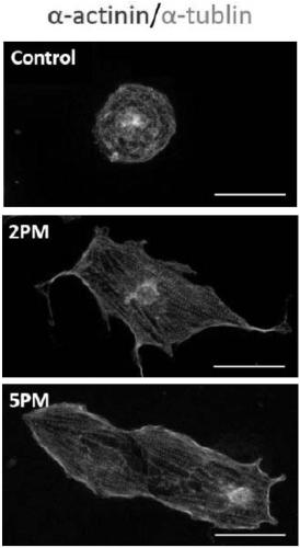 Myocardial cells preparation method