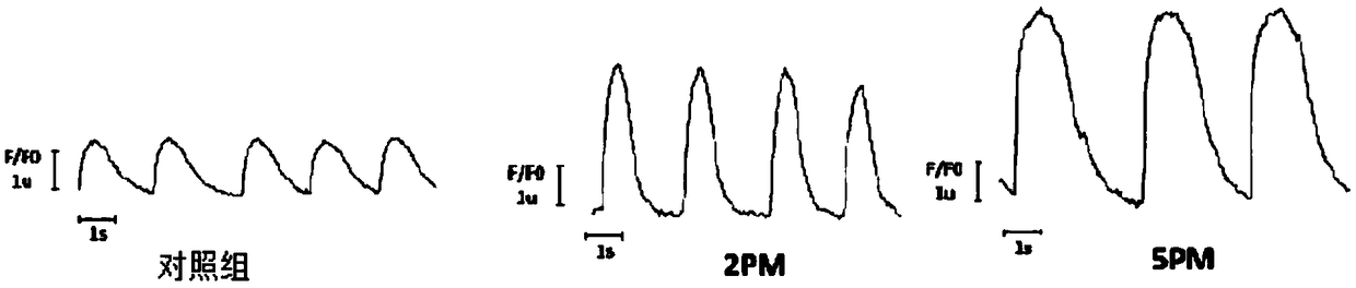 Myocardial cells preparation method