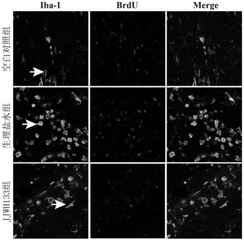 Application of type-II cannabinoid receptor agonist in preparation of drugs for treating hypertensive cerebral hemorrhage