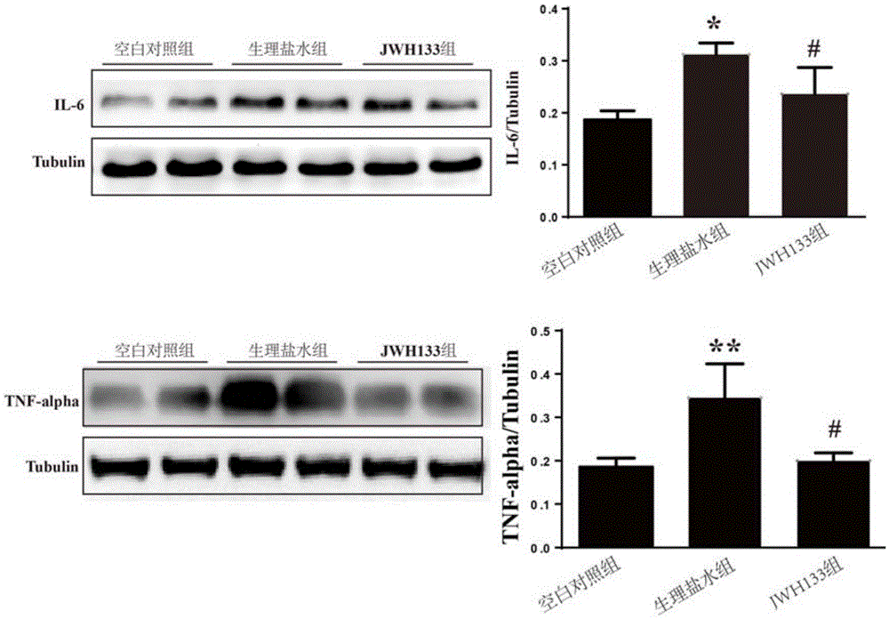 Application of type-II cannabinoid receptor agonist in preparation of drugs for treating hypertensive cerebral hemorrhage