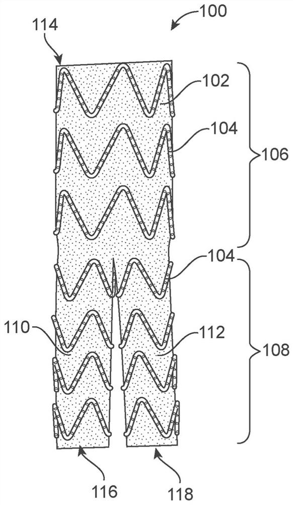 Bifurcating branch modular iliac branch device