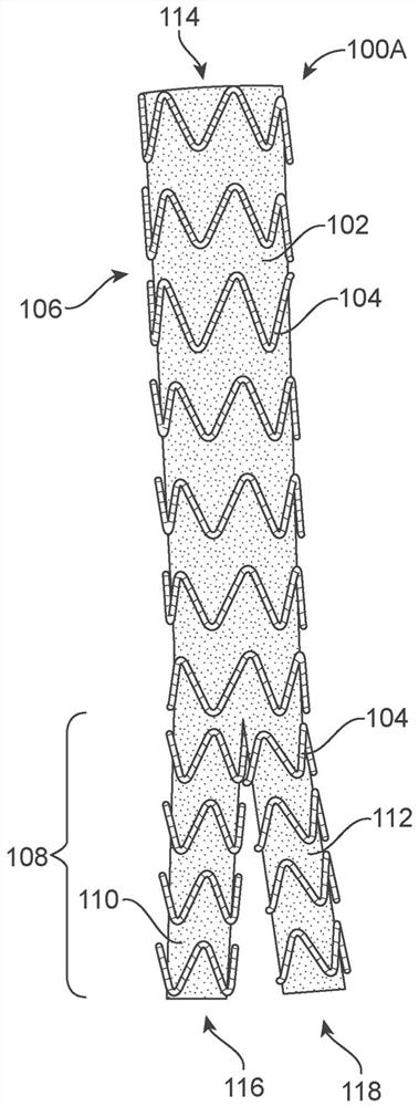 Bifurcating branch modular iliac branch device