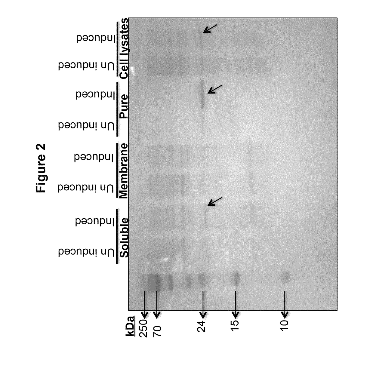 Analytical and diagnostic methods utilizing shigella flexneri apyrase