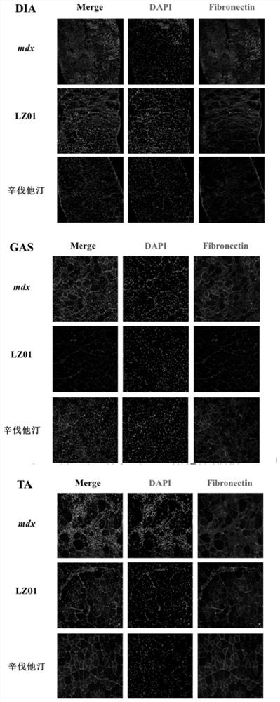 Application of LZ01 in treatment of Duchenne muscular dystrophy