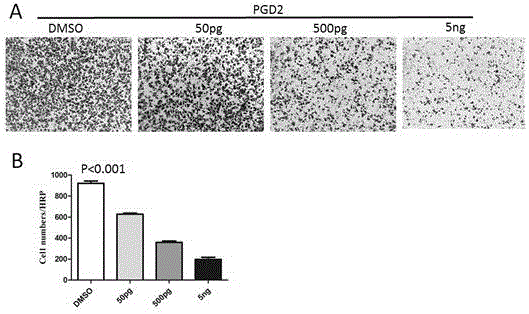 Application of PGD2 (prostaglandin D2) in preparation of drug for treating stomach cancer