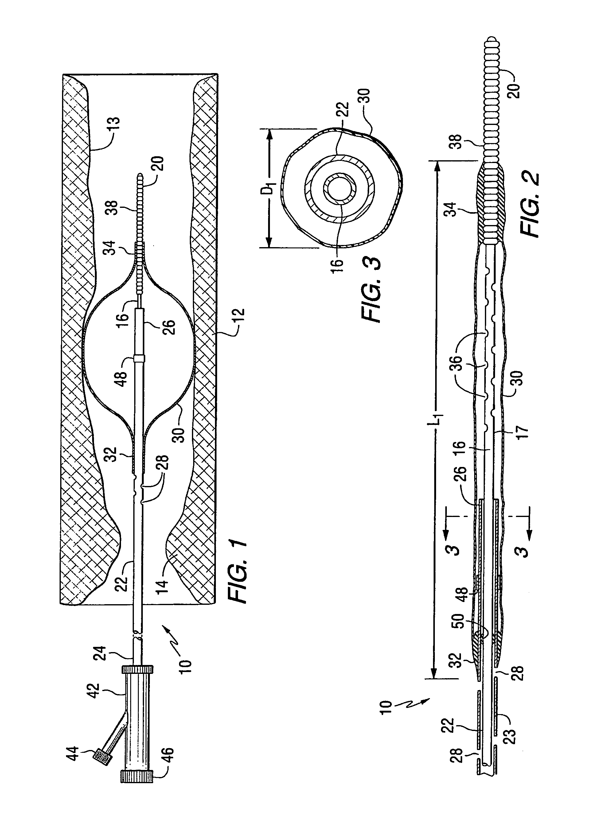 Apparatus for thromboembolic protection