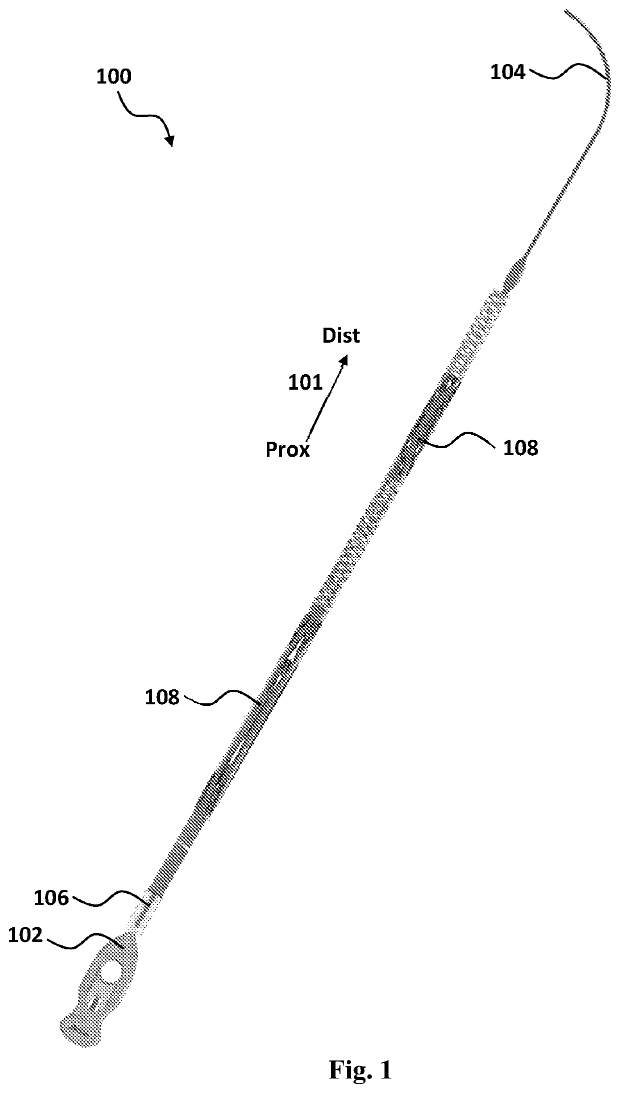 Devices for the removal of clots