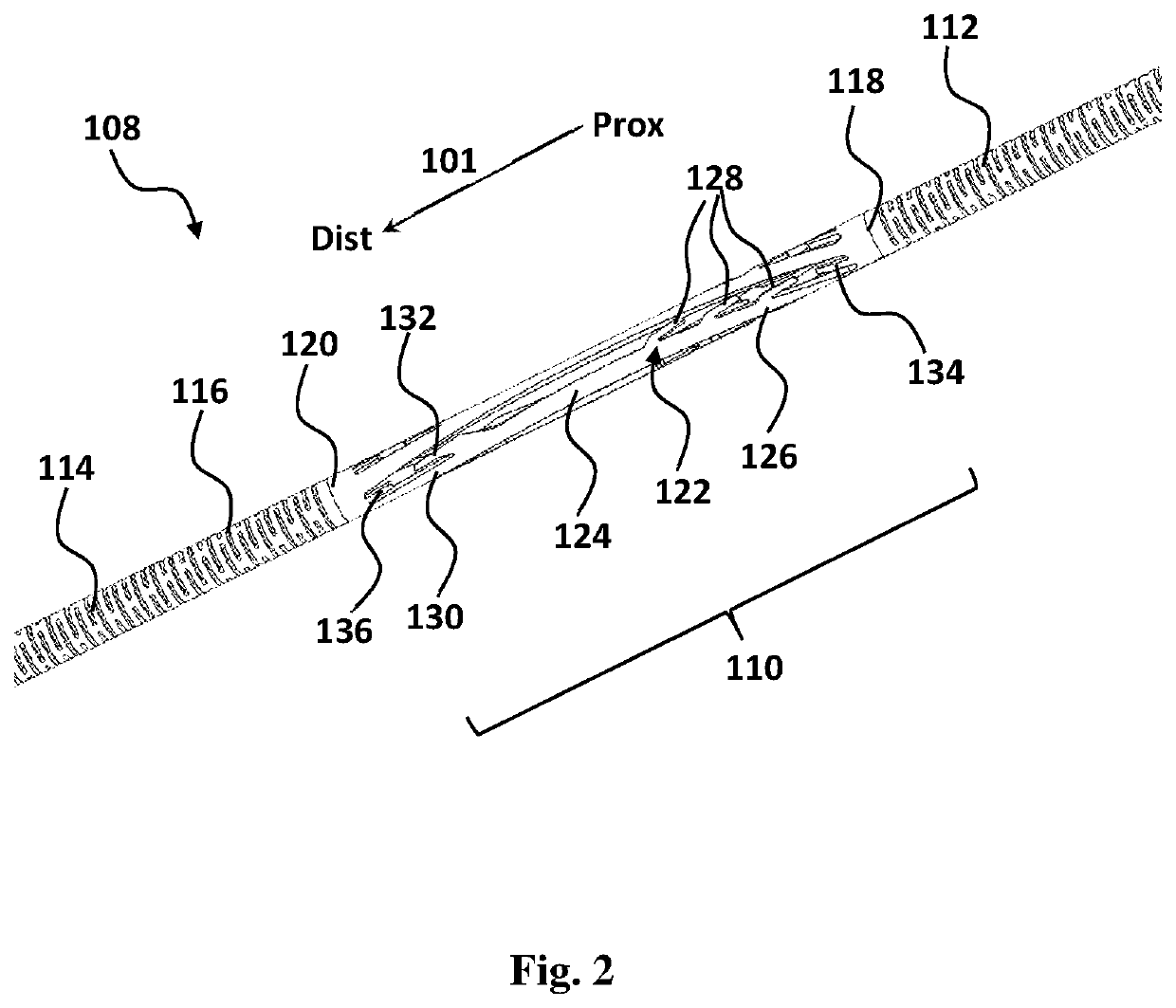 Devices for the removal of clots