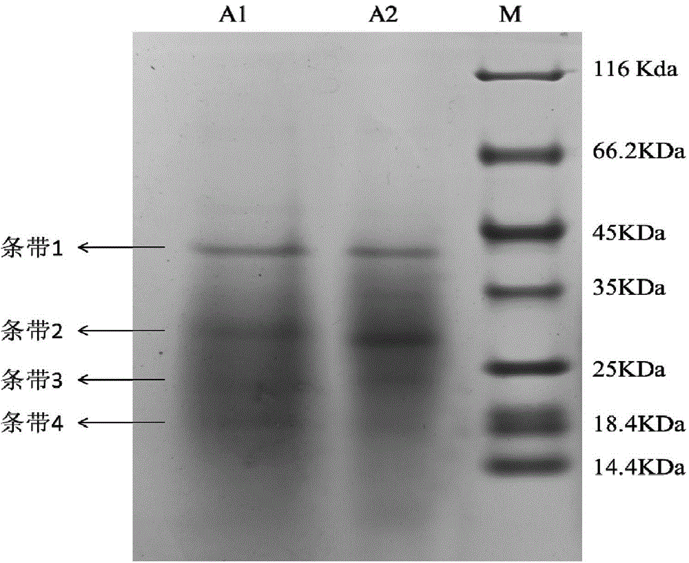 Zen toxin-degrading enzyme oxa of Acinetobacter and its coding gene and application