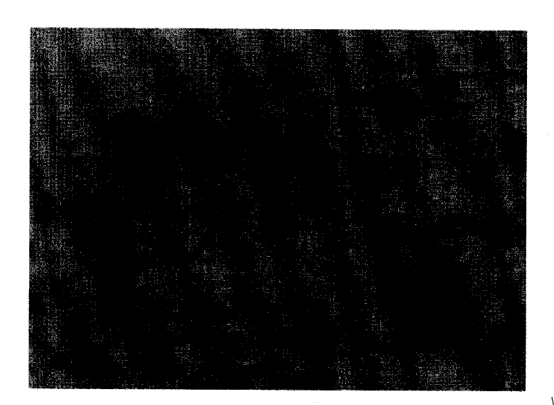 Comprehensive detection kit for early carcinoma of prostate, detecting method and use thereof