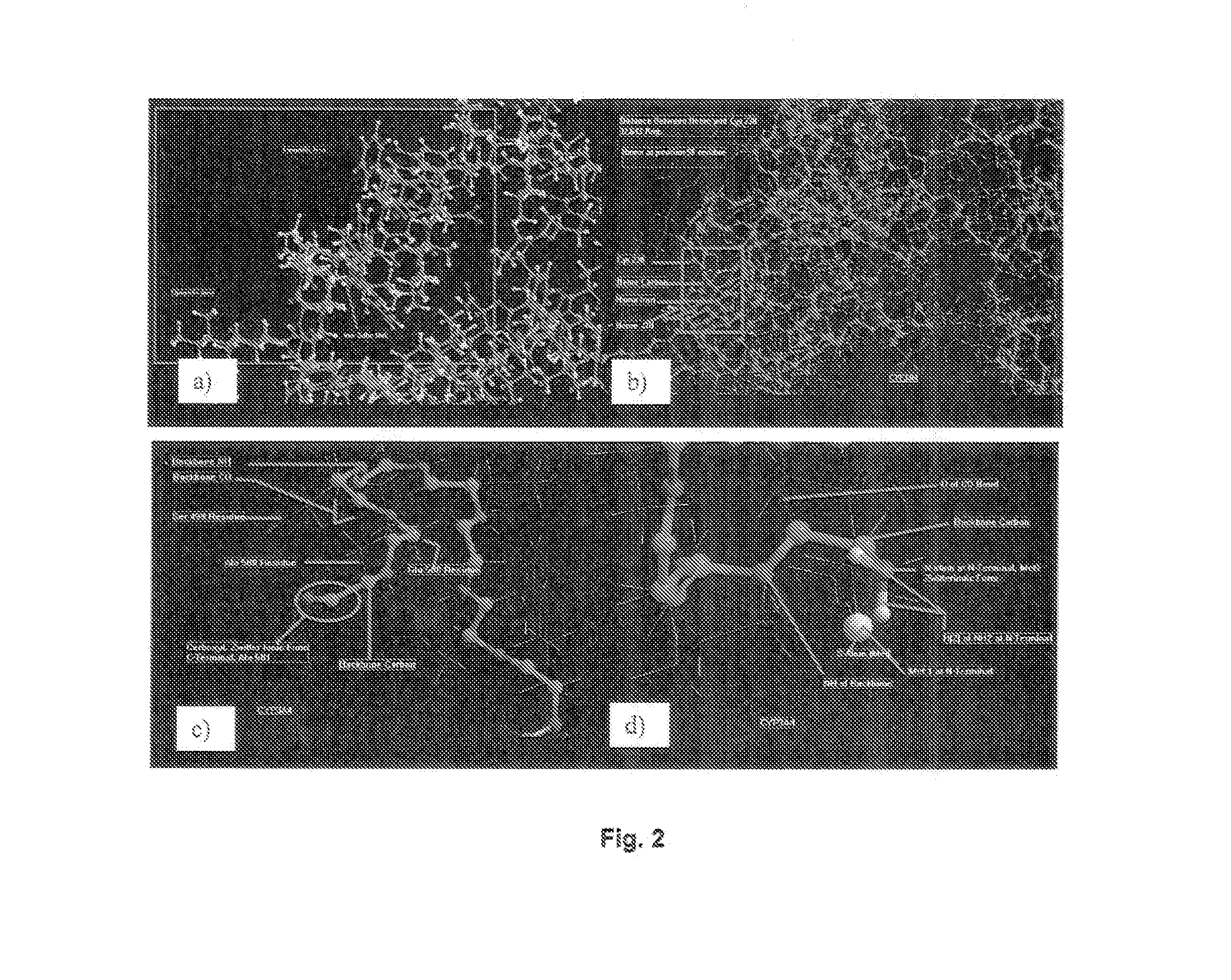 Pharmaceutical composition