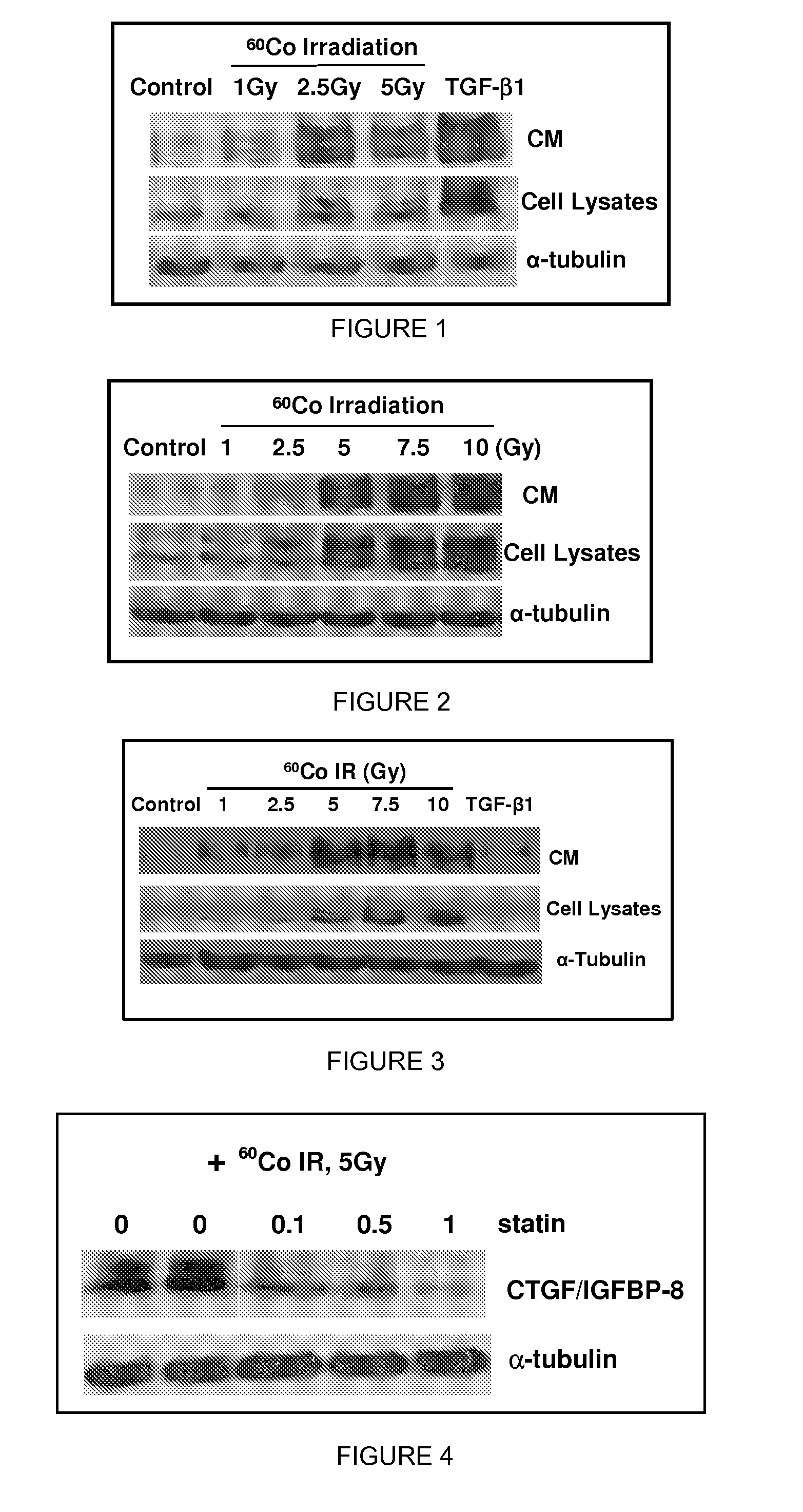Methods and compositions for treatment or prevention of radiation-induced fibrosis