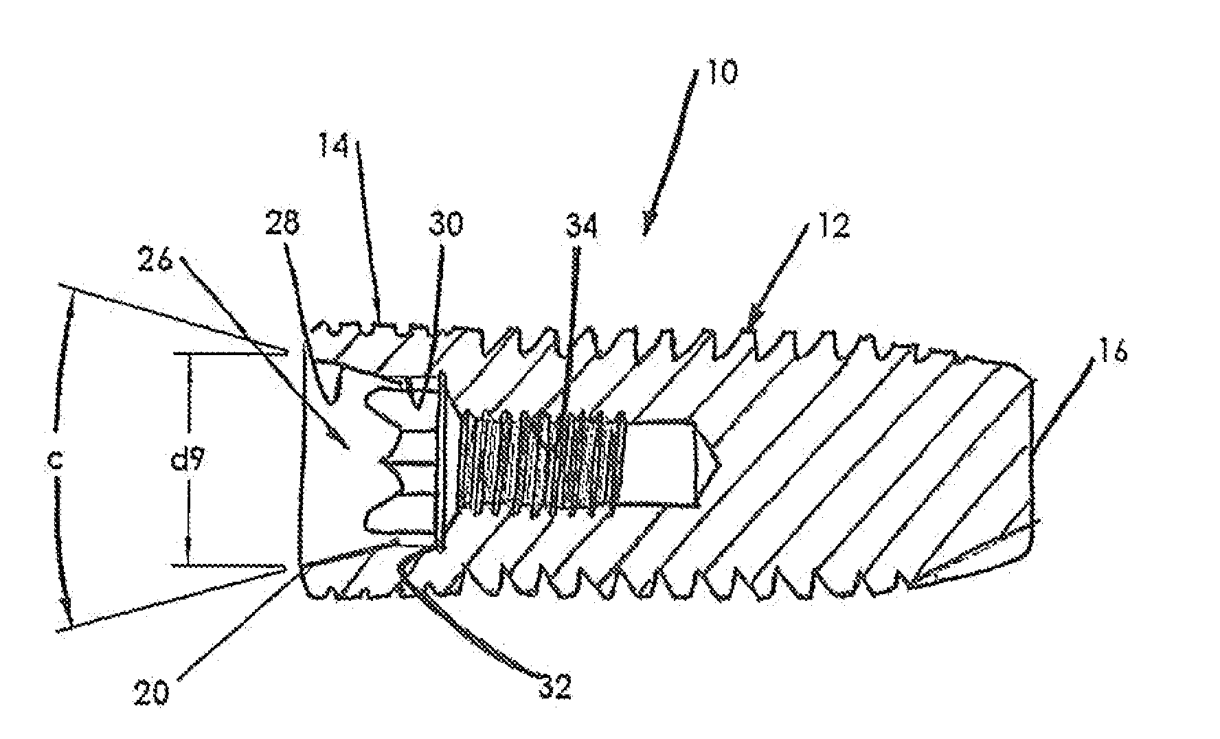Flexible Abutment For Use With A Dental Implant