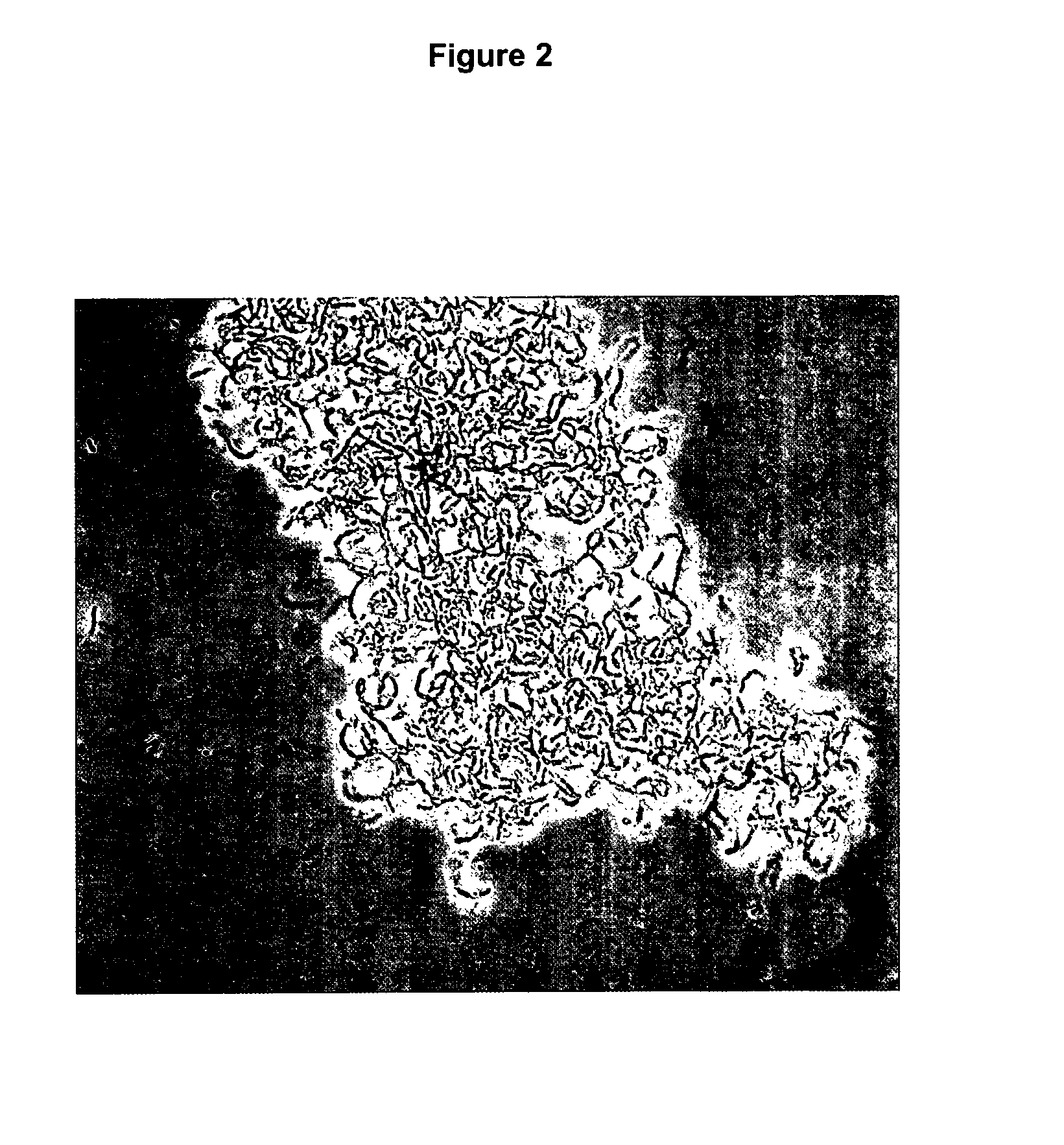 Microorganism of the genus Lactobacillus capable of binding to S. mutans and compositions comprising the same