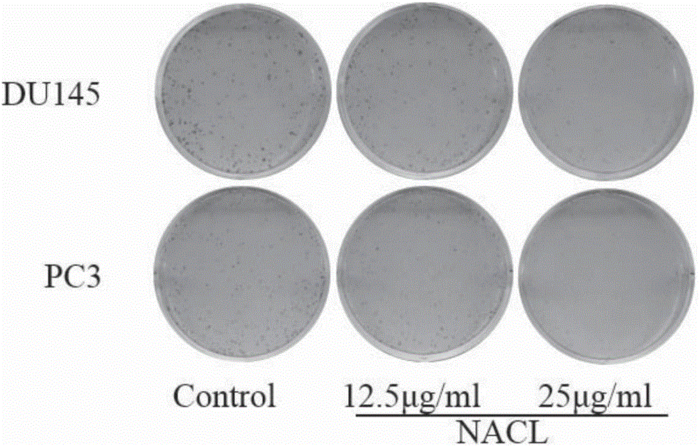 Aegiceras corniculatum leaf n-butyl alcohol extract and preparation method and application thereof to prostatic cancer treatment