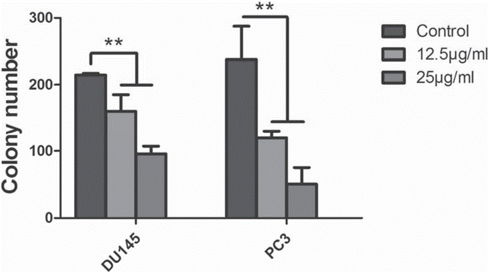 Aegiceras corniculatum leaf n-butyl alcohol extract and preparation method and application thereof to prostatic cancer treatment