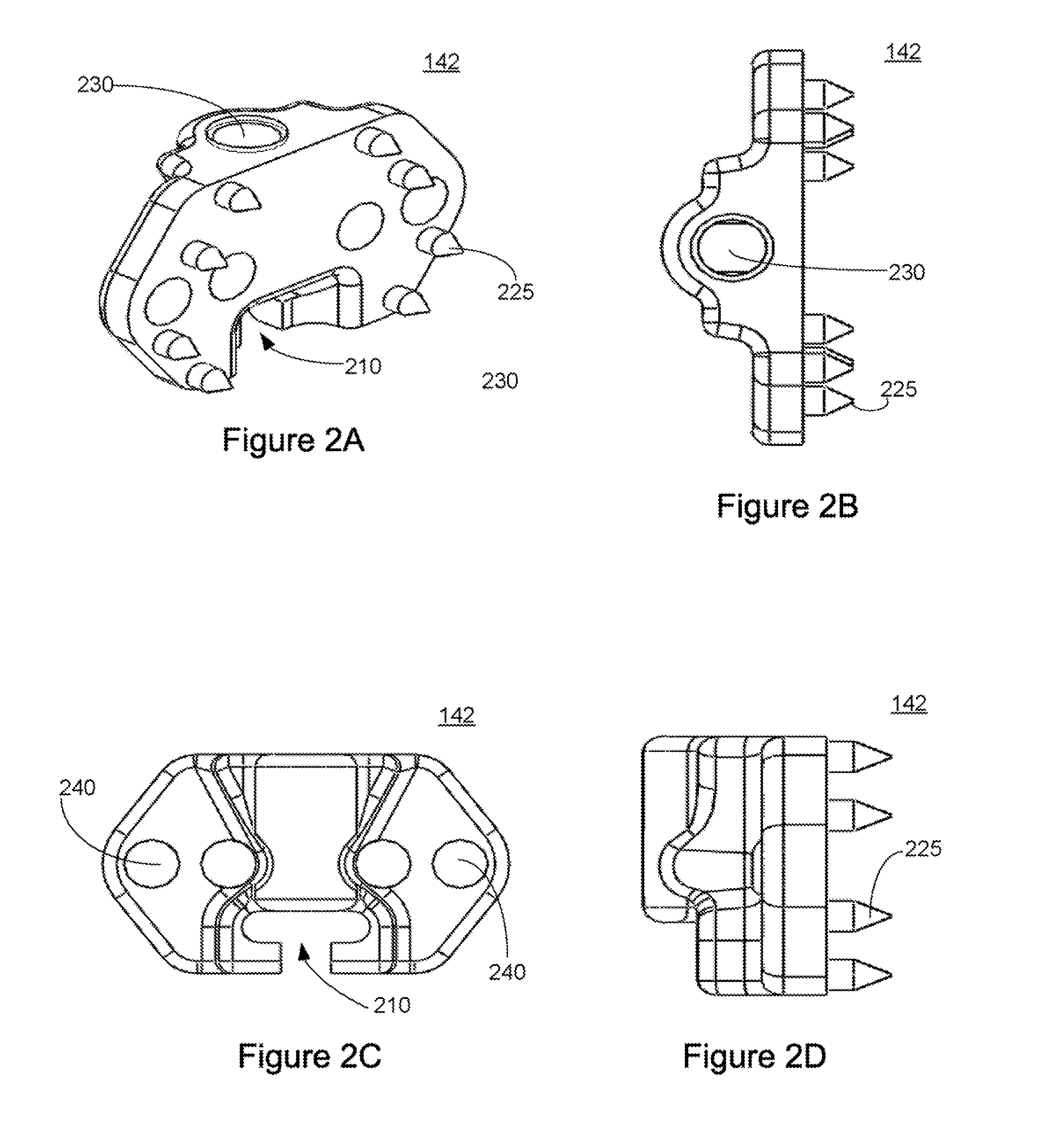 Interspinous Process Spacing Device