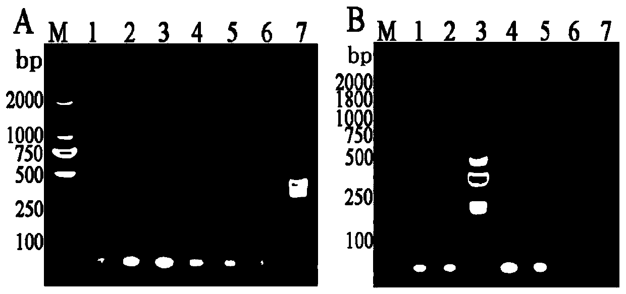 LAMP detection reagent kit of food-borne yersinia enterocolitica and application of LAMP detection reagent kit