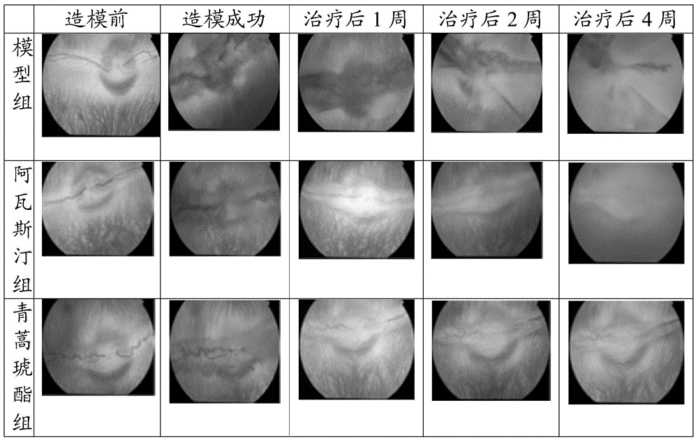 Application of artemisinin and derivatives thereof in preparation of ophthalmic vascular disease prevention and treatment medicines, and medicinal composition