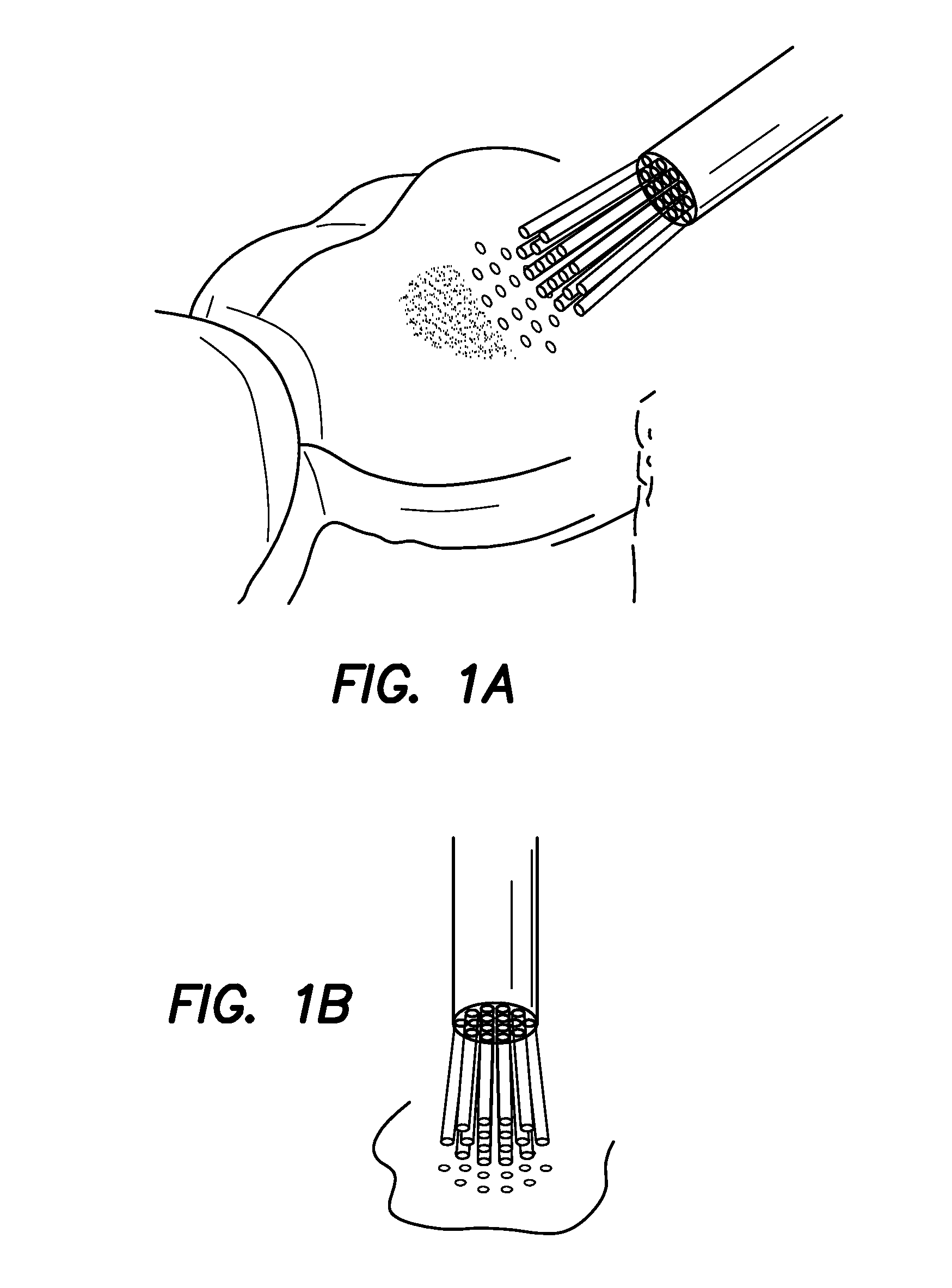 Probes and biofluids for treating and removing deposits from tissue surfaces