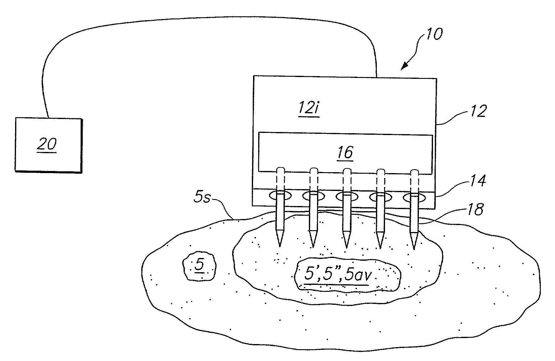 Tissue surface treatment apparatus and method