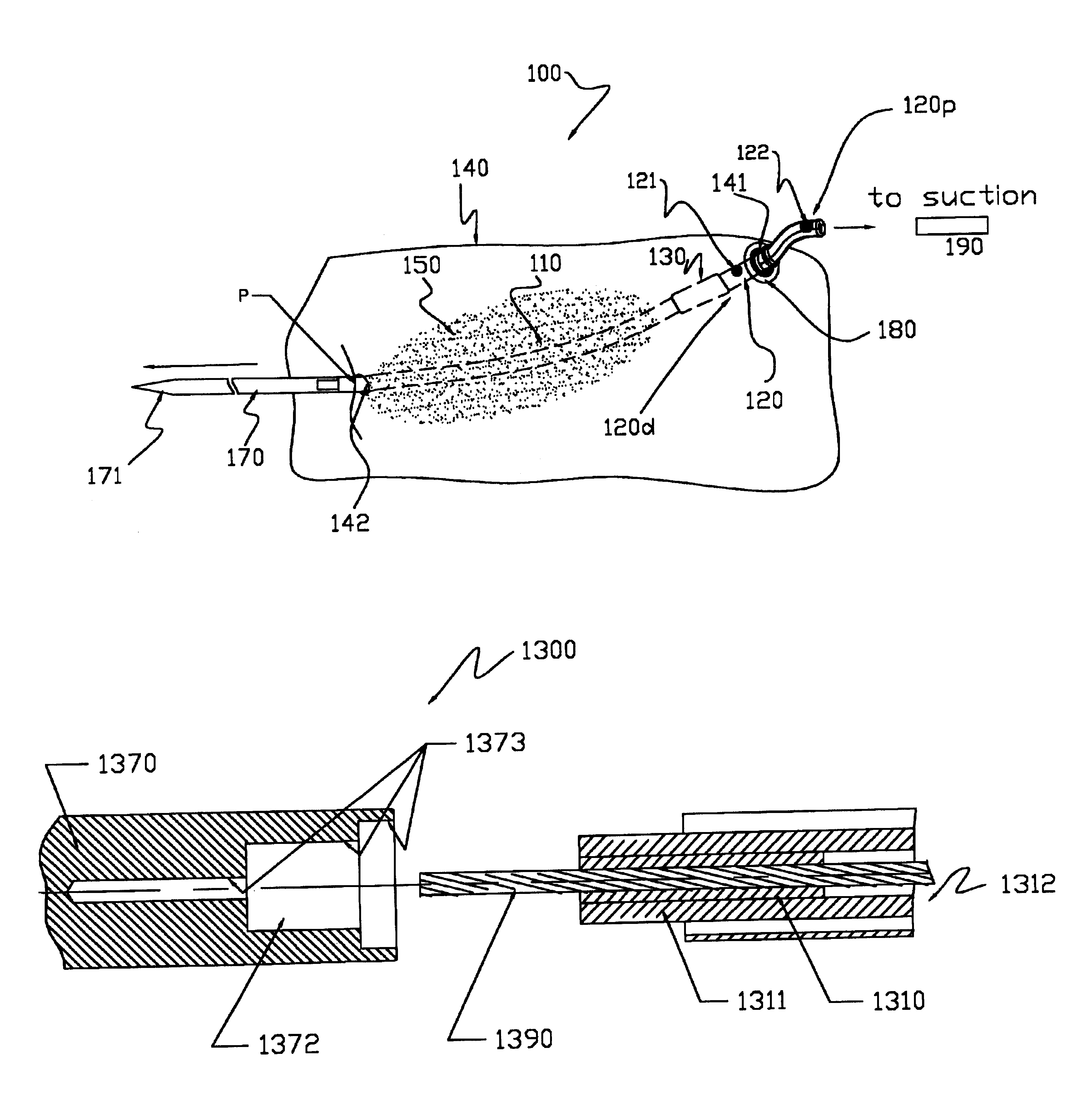 Drain catheters