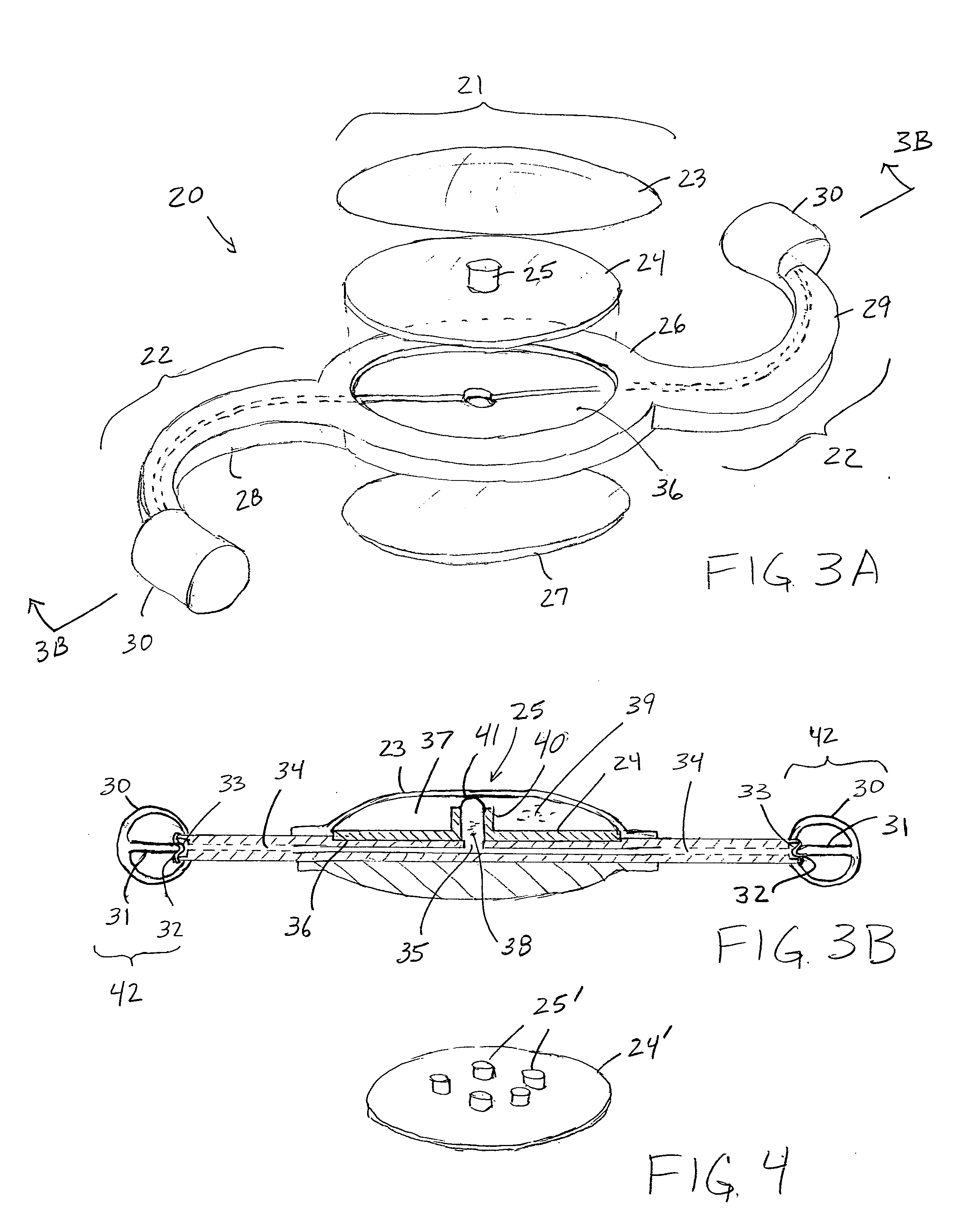 Accommodating intraocular lens system and method
