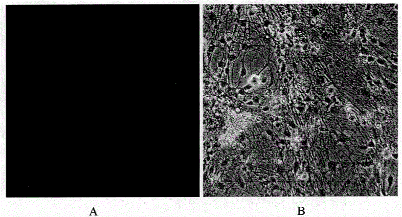 Method for inducing and culturing umbilical cord mesenchymal stem cells into nerve cells