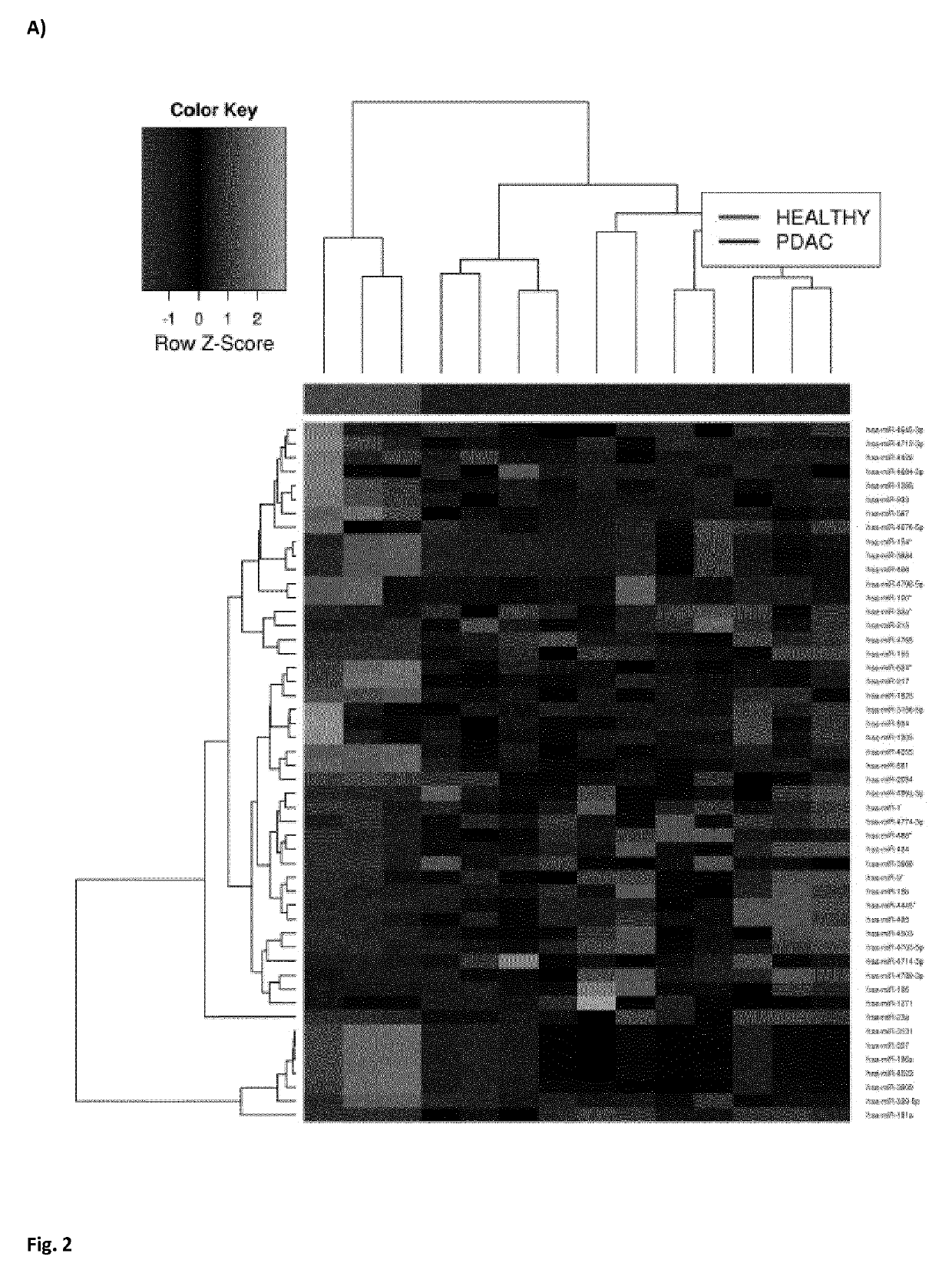 In vitro method for identifying pancreatic cancer or intraductal papillary mucinous neoplasm of the pancreas