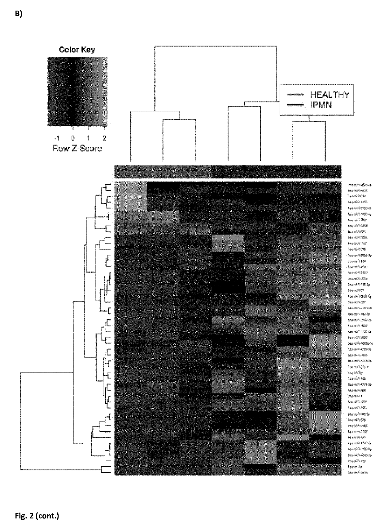 In vitro method for identifying pancreatic cancer or intraductal papillary mucinous neoplasm of the pancreas