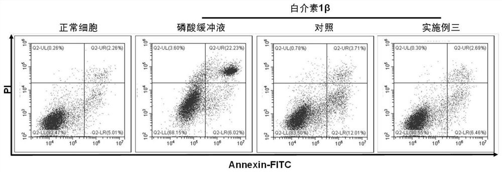 A kind of sialic acid modified composite nano drug delivery system and its preparation and application