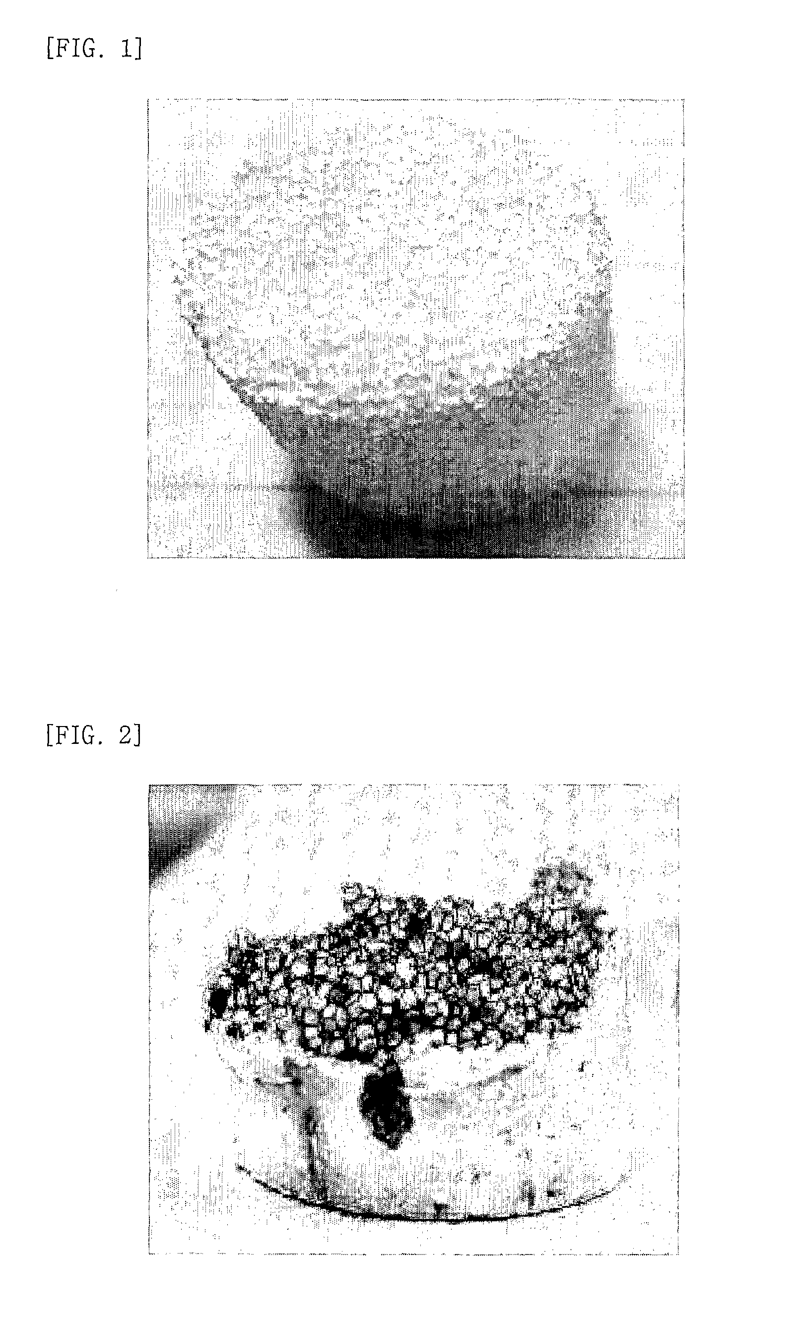 Composite implant having porous structure filled with biodegradable alloy and method of magnesium-based manufacturing the same