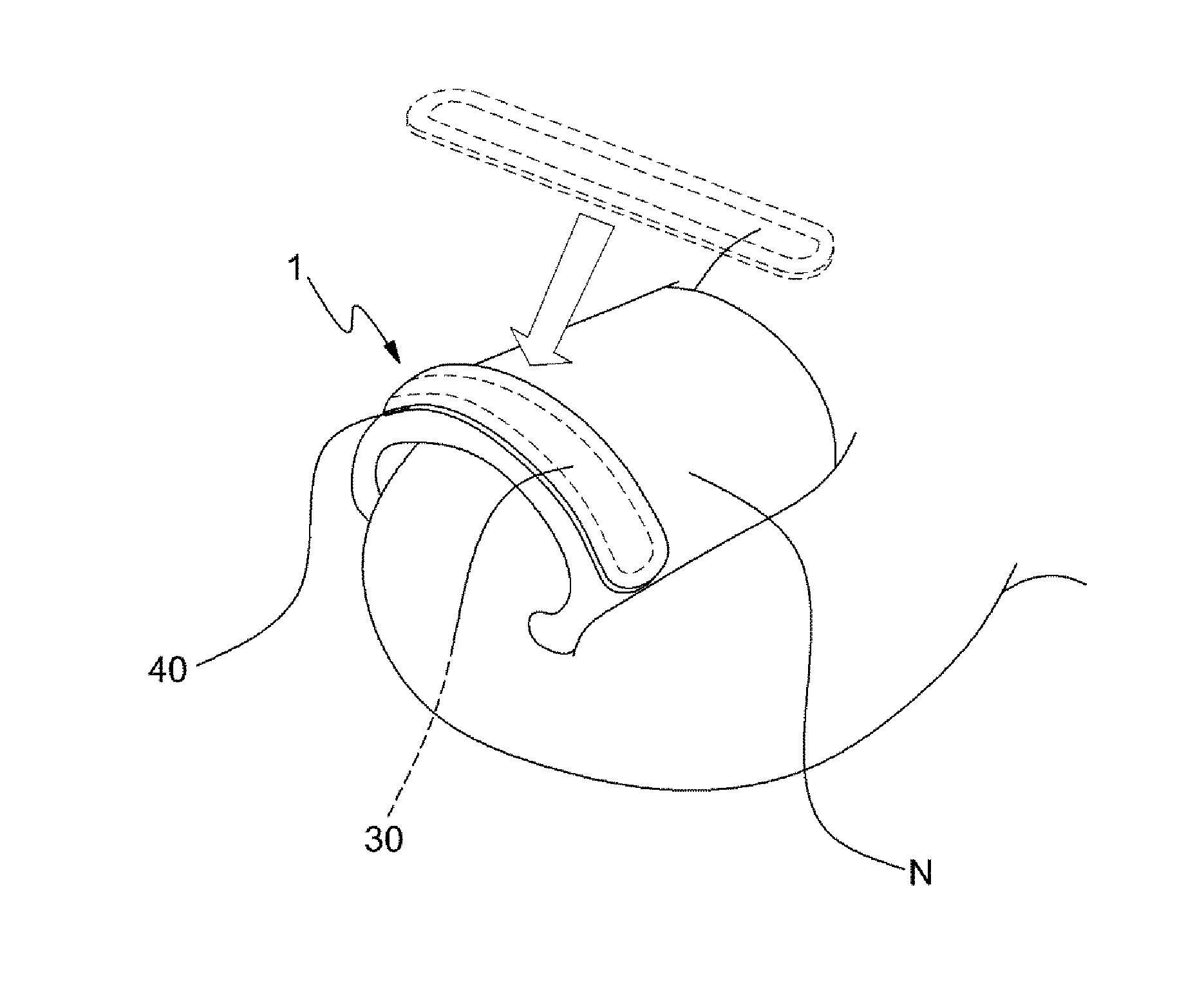 Nail deformity correction device and manufacturing method for nail deformity correction device