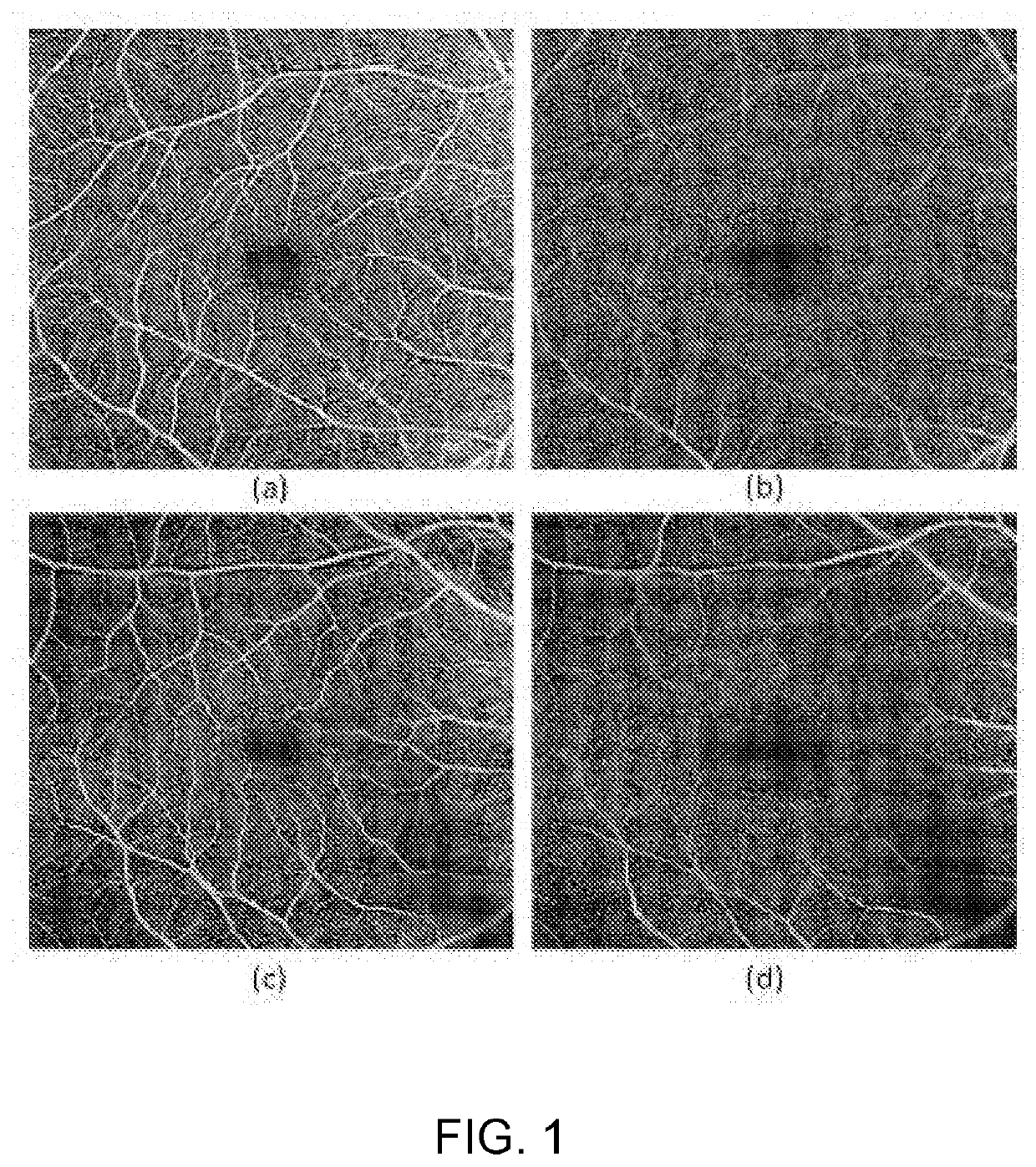 Segmentation of retinal blood vessels in optical coherence tomography angiography images