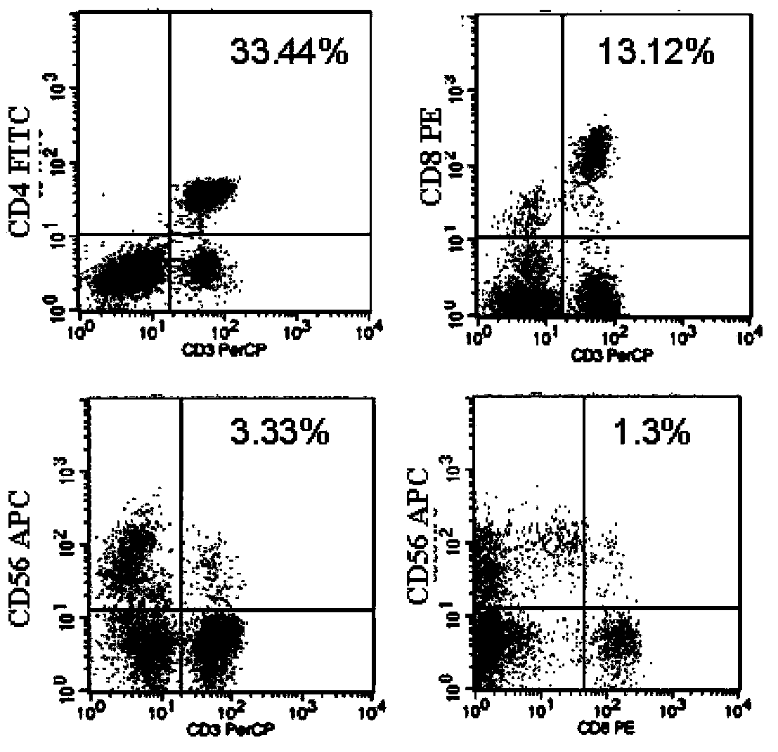 Application of CIK (cytokine induced killer) cell loaded by anti-CD3/anti-CD133 bispecific antibody