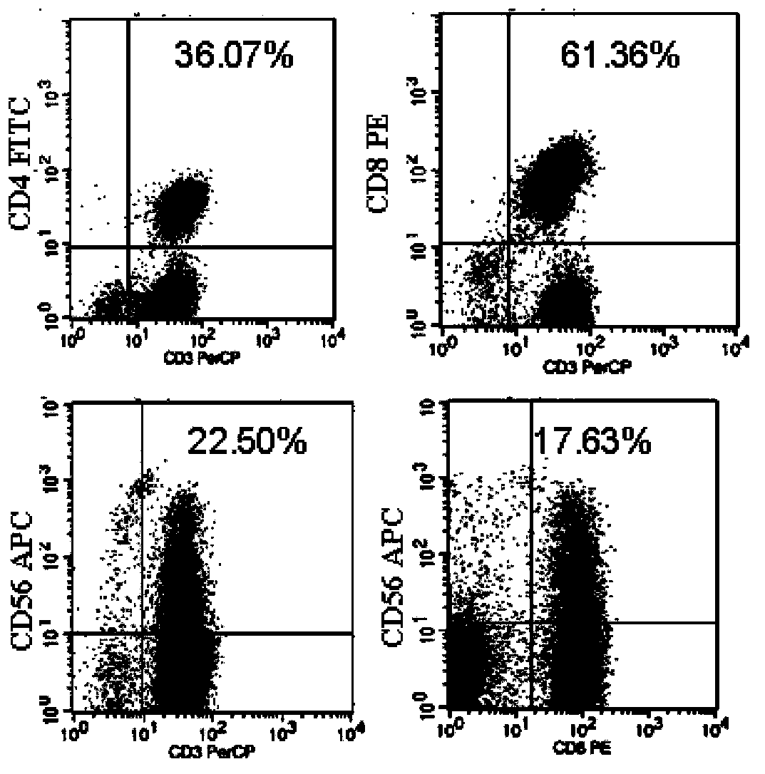 Application of CIK (cytokine induced killer) cell loaded by anti-CD3/anti-CD133 bispecific antibody