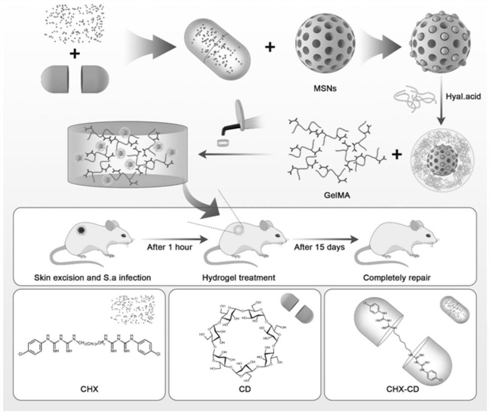 Ultra-long-acting controllable sustained-release mesoporous-hyaluronic acid hybrid targeted antibacterial nanomaterial and its preparation method and use