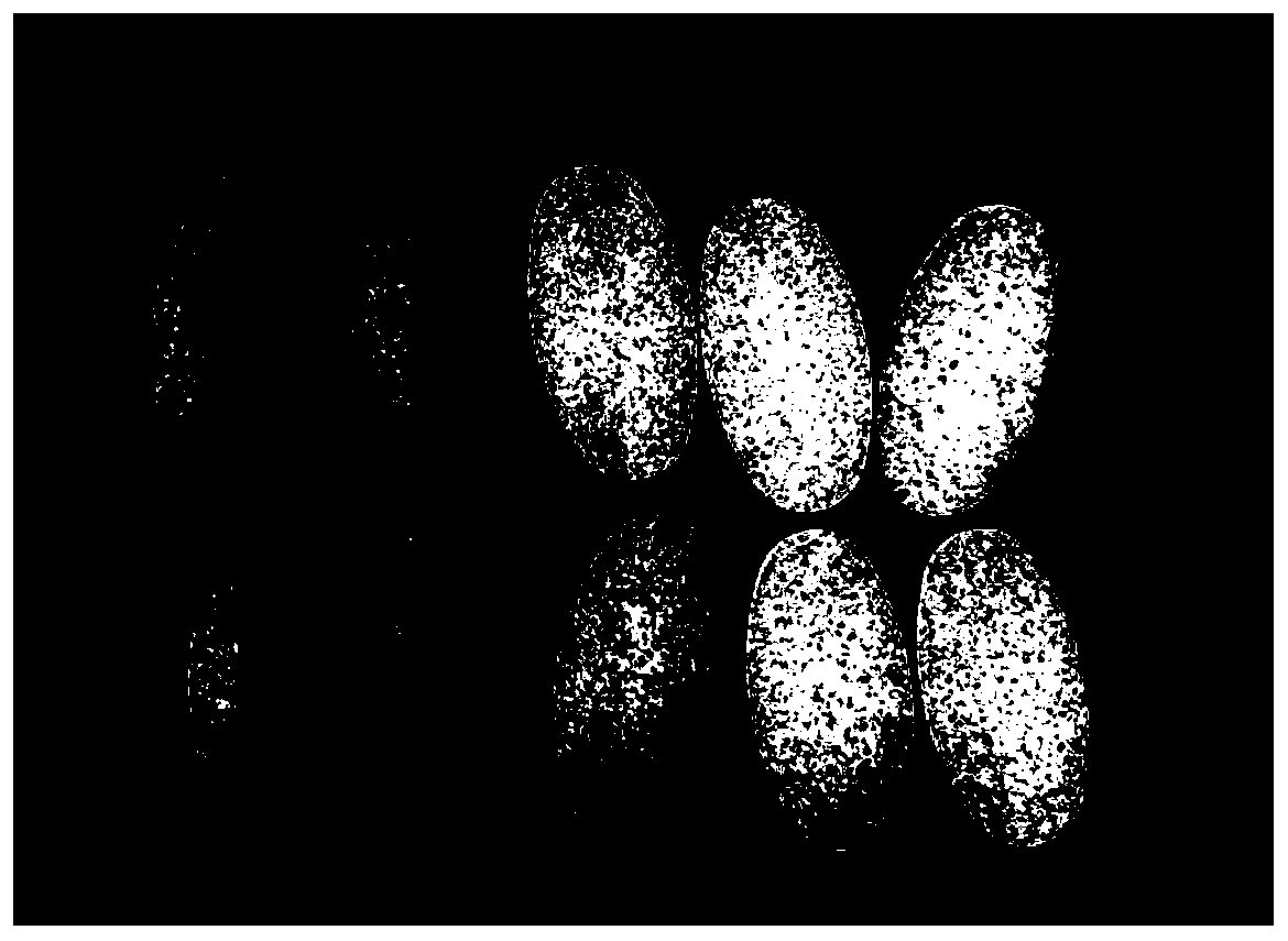 Compound preparation for treating oral ulcer and preparation method thereof