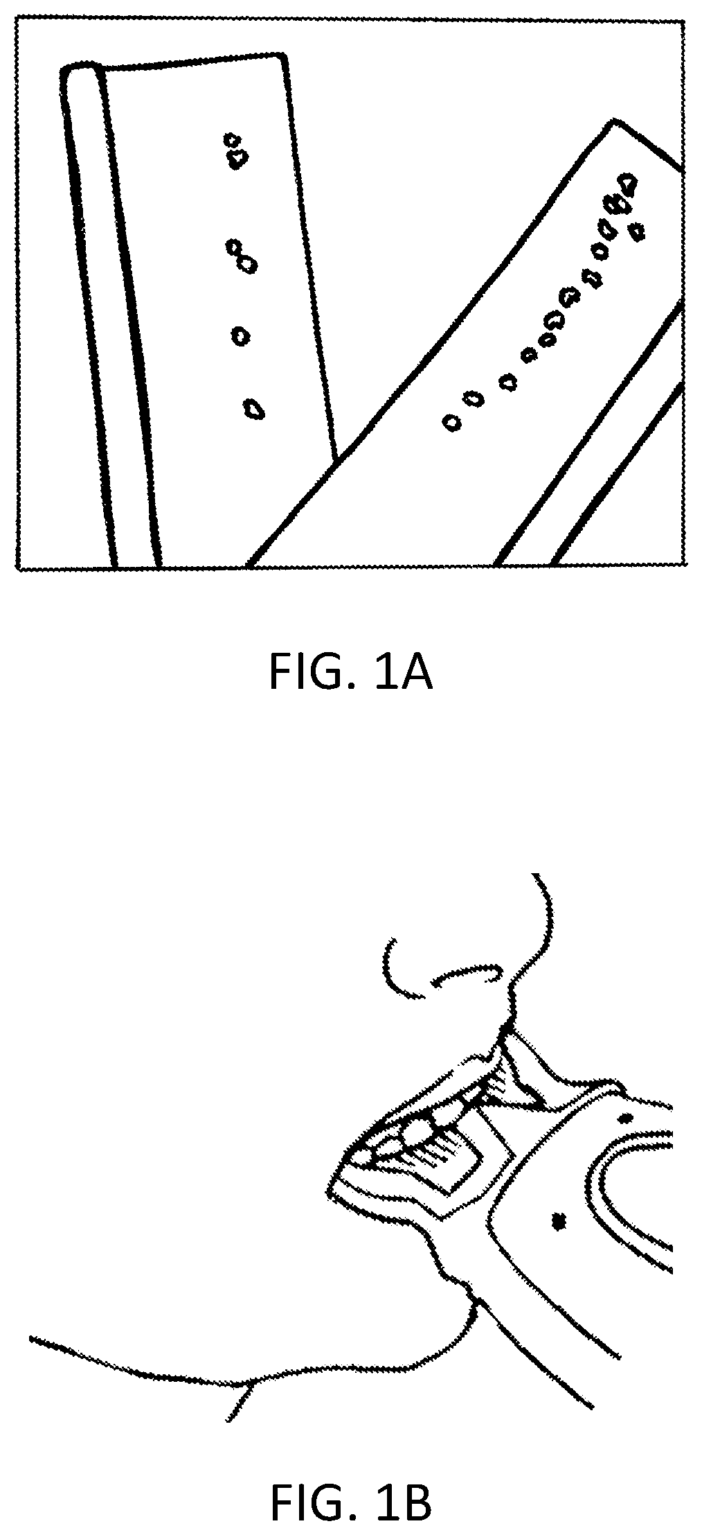 Capacitive sensor array for dental occlusion monitoring