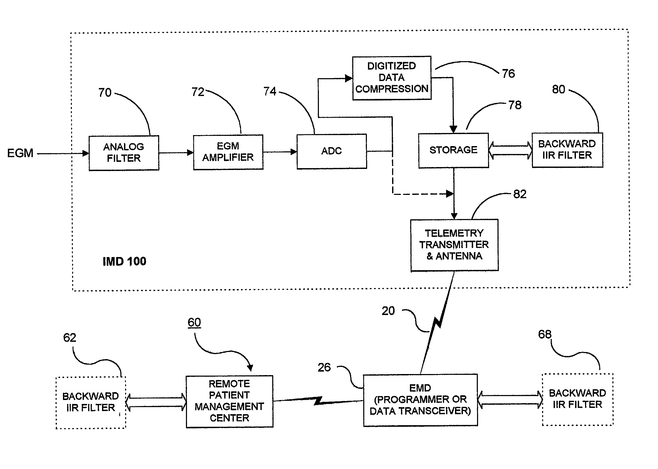 Methods and apparatus for filtering EGM signals detected by an implantable medical device