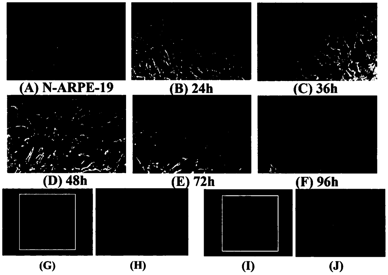 Epithelial-mesenchymal transition model of retinal pigment epithelium and its application