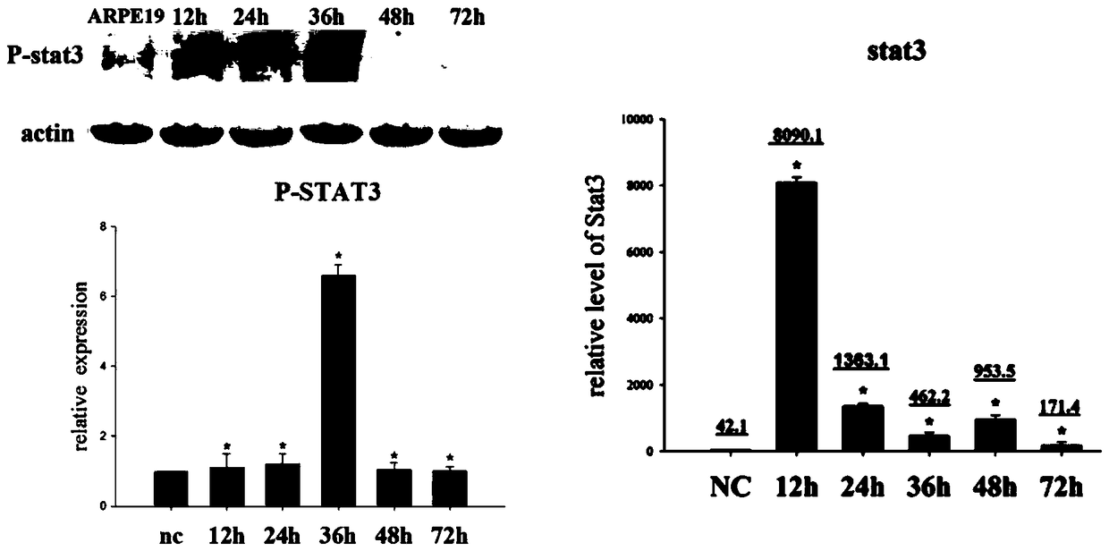 Epithelial-mesenchymal transition model of retinal pigment epithelium and its application